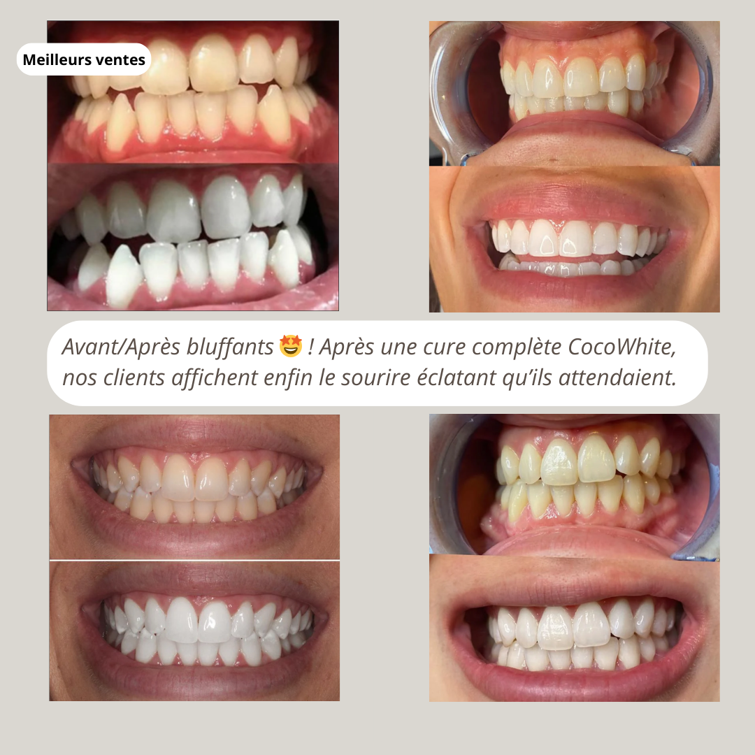Kit Blanchiment Naturel - CocoWhite