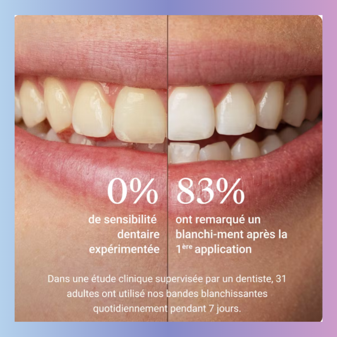 CocoWhite - FlashSmile™