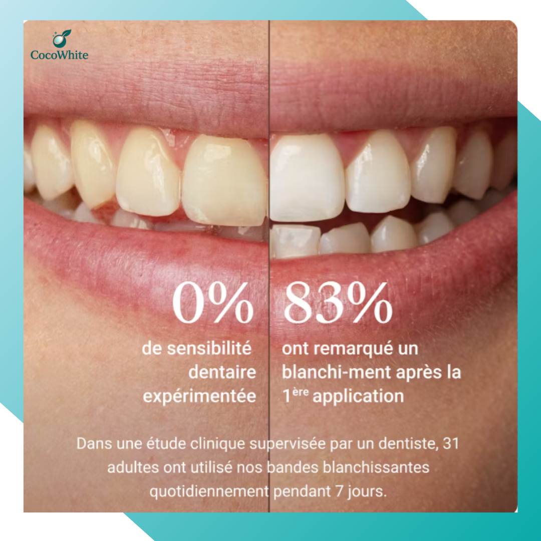 CocoWhite - FlashSmile™